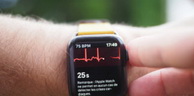 L’électrocardiogramme de l’Apple Watch 4 change la donne
