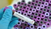 Coronavirus: Faut-il décréter le huis clos dans nos stades ?