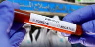 Coronavirus : 276 nouveaux cas, 178 guérisons et 8 décès ces dernières 24 heures en Algérie