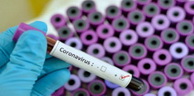 Coronavirus: 548 nouveaux cas, 230 guérisons et 10 décès ces dernières 24 heures en Algérie