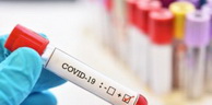 Coronavirus: 1044 nouveaux cas, 622 guérisons et 21 décès ces dernières 24 heures en Algérie