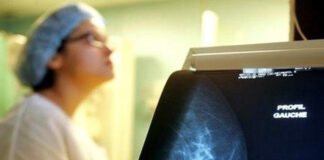 Mascara: Le dépistage précoce du cancer du sein vivement recommandé pour une protection efficace contre la maladie