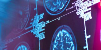 Des scientifiques enregistrent ce qu’il se passe dans le cerveau au moment de la mort