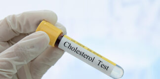 Cholestérol : les 4 pires aliments, selon une cardiologue