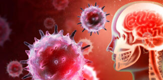 Covid-19 : ce que des autopsies révèlent