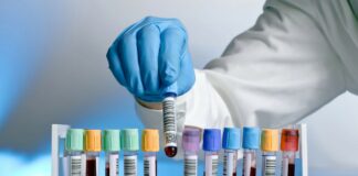 Hémoglobine: Quel est le taux normal et comment l’interpréter