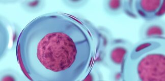 Alzheimer: La piste immunitaire évoquée