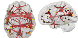 Trisomie 21: La restauration d’une hormone clé pourrait améliorer les fonctions cognitives