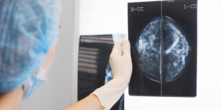 El-Eulma: Dépistage précoce du cancer du sein pour plus de 1000 femmes