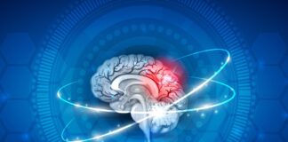 Des chercheurs français ont développé un traitement innovant contre l’AVC