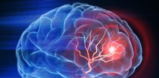 Première mondiale: Un enfant de 13 ans guéri d’un cancer du cerveau jusque-là incurable