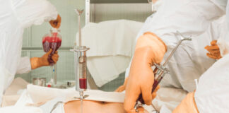 EHU d’Oran: 1 038 greffes de la moelle osseuse entre 2009 et 2023