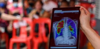 Traitement révolutionnaire contre la tuberculose en Asie-Pacifique