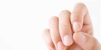 Cancer: Surveillez vos ongles, ils peuvent indiquer une prédisposition