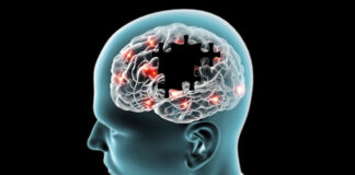 Un cerveau actif peut vous protéger de la démence