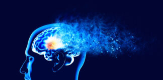 Démence: Un facteur de vie pourrait prévenir jusqu’à un cas sur cinq, selon des scientifiques