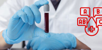 Le groupe sanguin, un facteur de risque d’AVC précoce selon une étude américaine