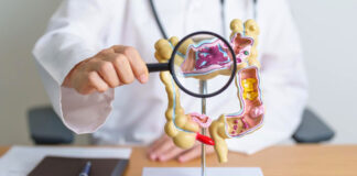 Stress chronique et cancer colorectal: L’intestin, une voie d’aggravation discrète