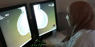 Sétif: L’importance du dépistage précoce du cancer du sein chez les femmes enceintes soulignée