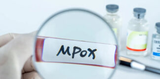 Près de 60 000 cas de mpox en Afrique, 20 pays touchés