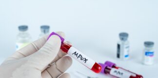 USA: Premier cas de Mpox détecté en Californie