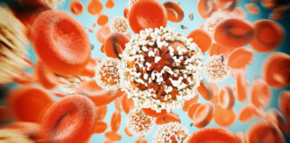 Ce cancer rare chez l’homme explose aux Etats-Unis, les patients ont un point commun