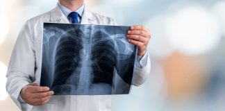 Tuberculose: Une baisse significative des cas et une mobilisation accrue des autorités