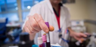 Un test sanguin prometteur pour détecter la récidive du cancer bien avant les scanners