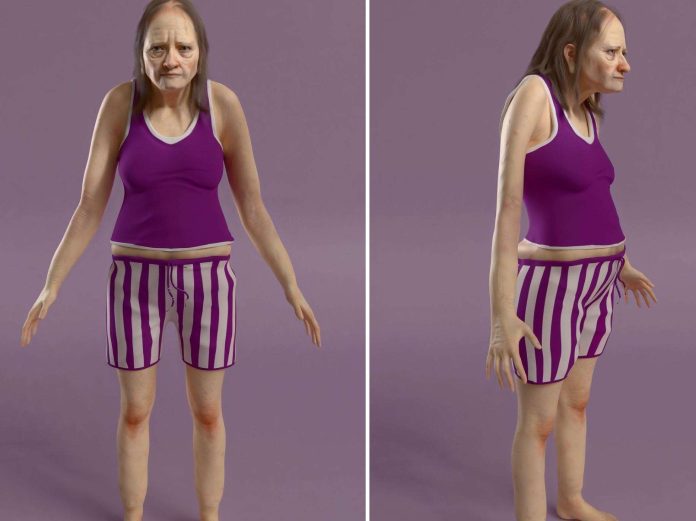 Voici à quoi vous pourriez bientôt ressembler si vous ne changez pas cette mauvaise habitude !