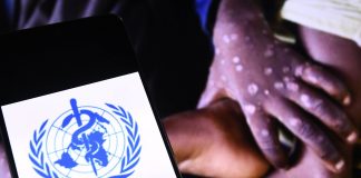 OMS « le Mpox ne constitue plus une urgence de santé publique de portée internationale »