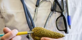 Cancer du pancréas: Ce premier signe repéré dans la bouche pourrait permettre un diagnostic précoce de la maladie