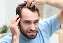 Calvitie: Un nouveau traitement promet une repousse miracle