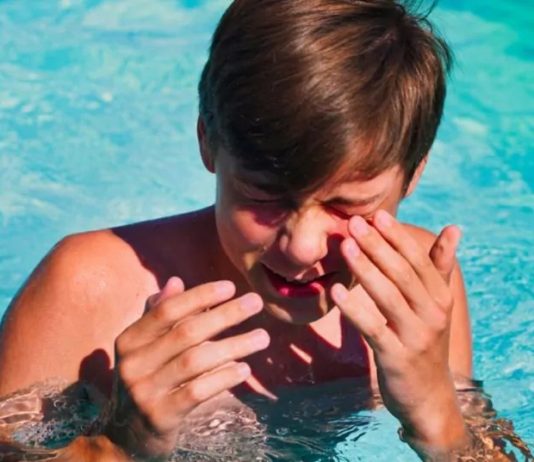 Froid, eau, sueur… ces allergies insolites peuvent parfois devenir très graves