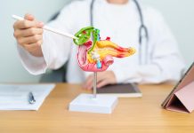 Cancer du pancréas: Une découverte ouvre la voie à de nouveaux traitements